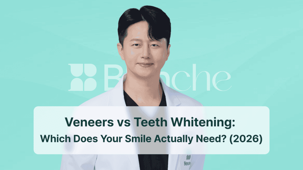 Veneers vs Teeth Whitening: Which Does Your Smile Actually Need? (2026)