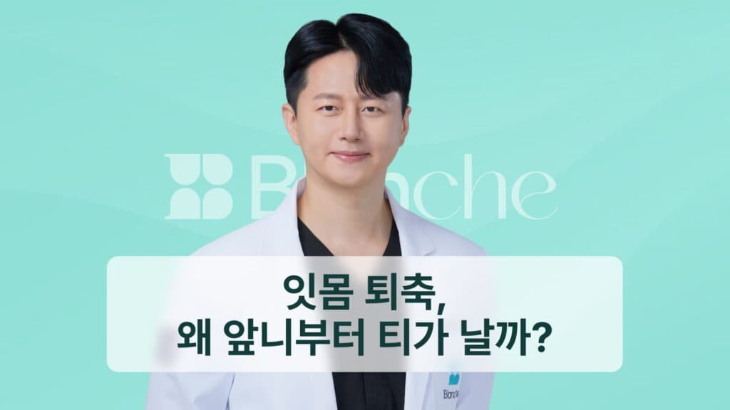 썸네일-잇몸퇴축, 왜 앞니부터 티가 날까?