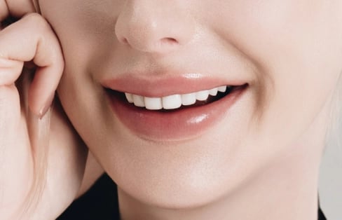 블랑쉬치과 구강전정술로 스마일 라인의 균형을 고려한 입술과 치아 이미지