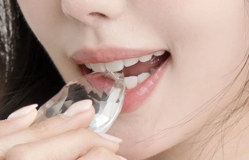 블랑쉬치과 입술 필러 시술로 입술 볼륨과 라인을 표현한 이미지