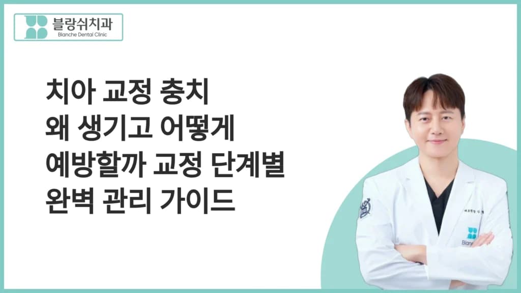 치아 교정 충치 왜 생기고 어떻게 예방할까 교정 단계별 완벽 관리 가이드 대표 이미지