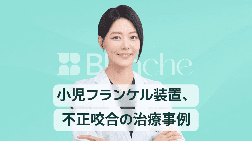 【韓国歯科】子どもの受け口や不正咬合の矯正、フランケル装置の治療症例