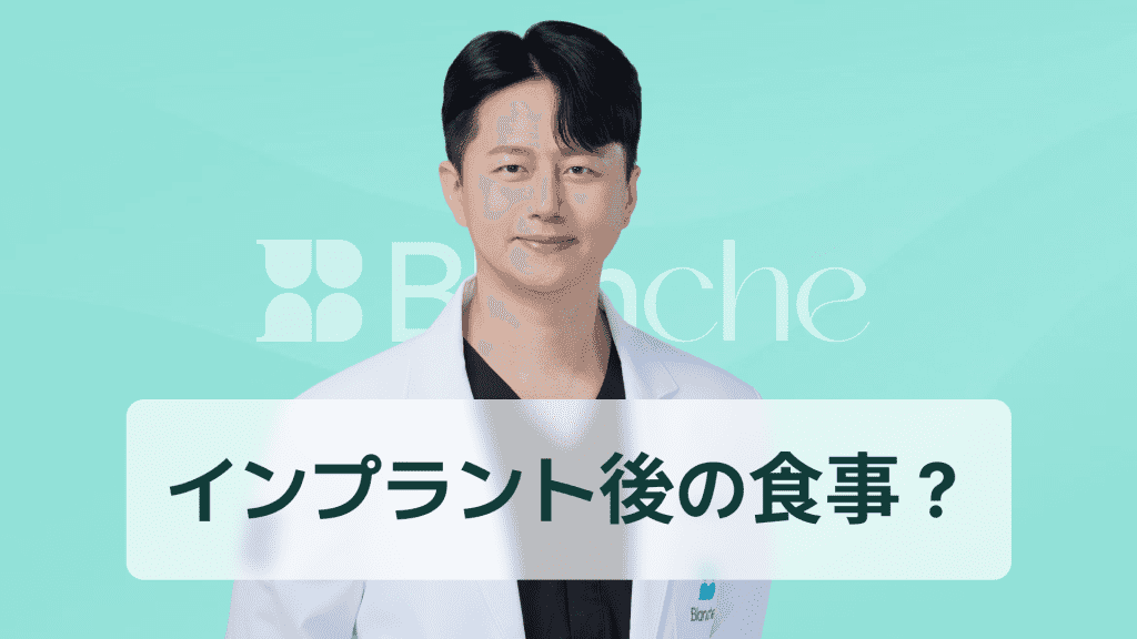 【韓国歯科】インプラント1次手術後の食事はいつ、どのようにすべきか? 手術当日の食事から回復期の食事まで完全まとめ