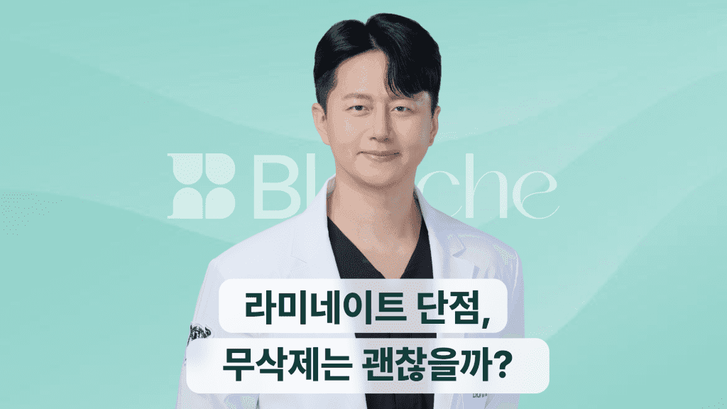 라미네이트 단점, 무삭제 단점은 없을까?