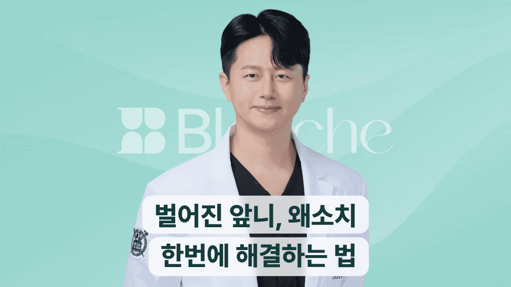 벌어진 앞니, 왜소치 한번에 해결하는 법