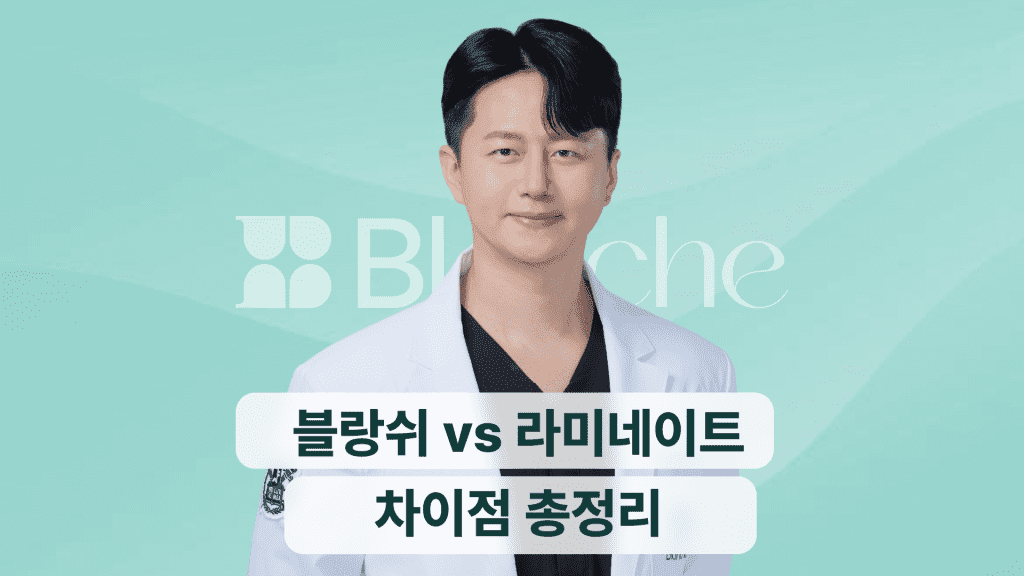 블랑쉬 vs 라미네이트 차이점 총정리