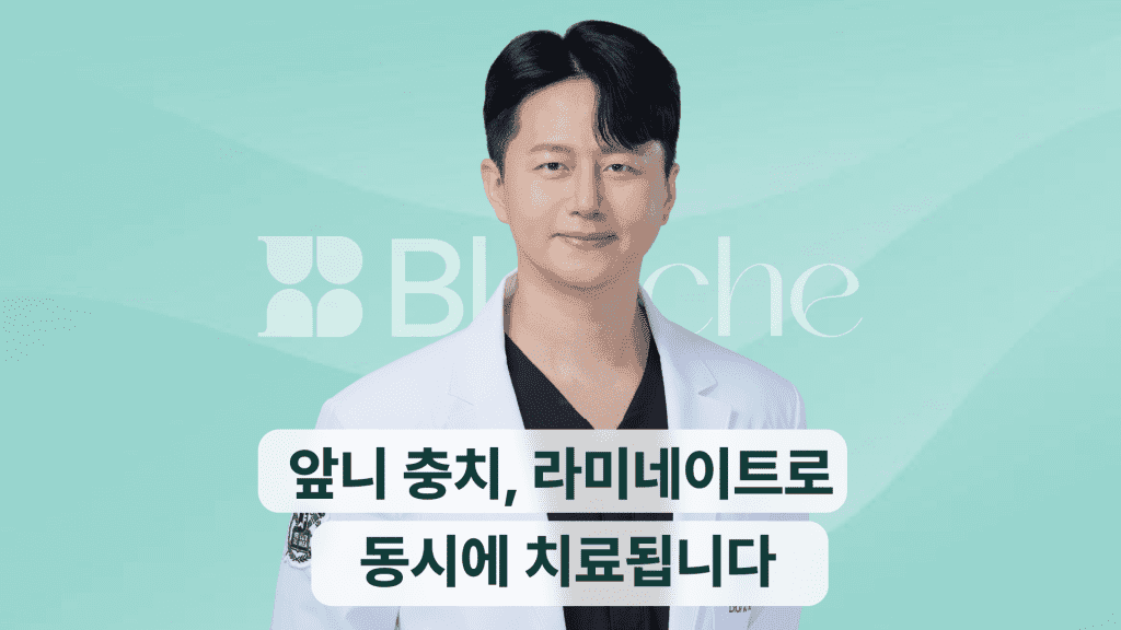 앞니 충치, 라미네이트로 동시에 치료됩니다