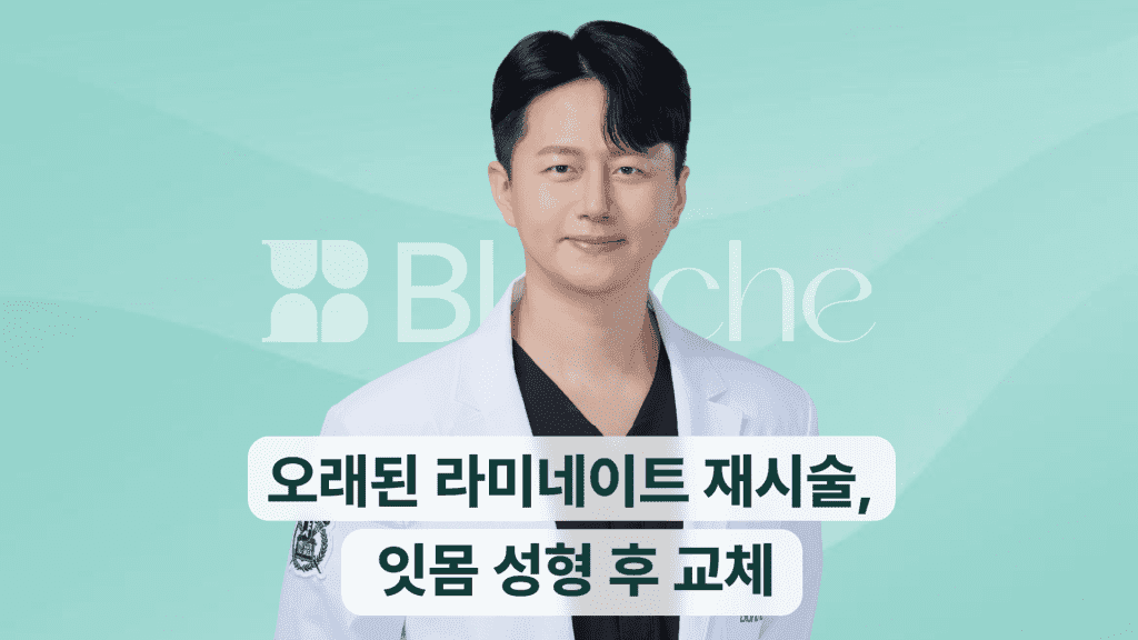 오래된-라미네이트-재시술-잇몸-성형-후-교체